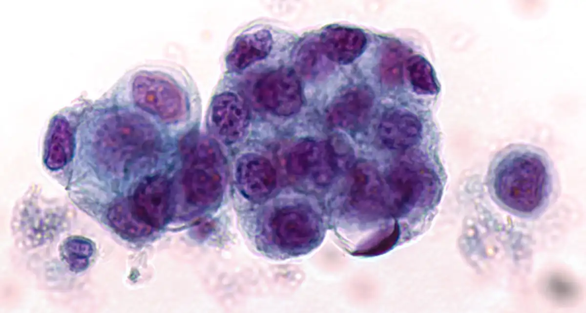 Pathologie Dres. med. Rudolf & Kollegen aus Hoyerswerda und Bautzen – Zytologie Zytologie