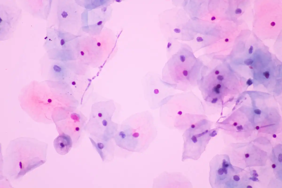 Pathologie Dres. med. Rudolf & Kollegen aus Hoyerswerda und Bautzen – Zytologie Zytologie